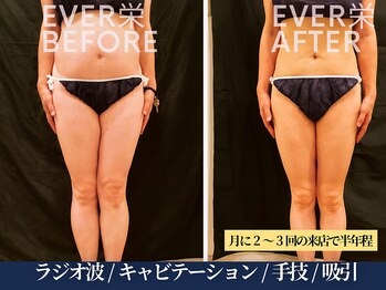 エヴァーグレース 宇都宮店/お悩みをしっかりお聞きしてから