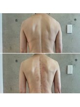 サプナジー(Suppnrgy)/カスタムトリートメント