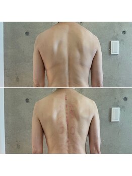 サプナジー(Suppnrgy)/カスタムトリートメント