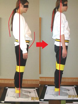 チャラク(charaku)/【30代Ｎ様：姿勢・骨盤矯正】