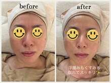 グランボヌール(grand bonheur)/【エステ　ベーシックコース】