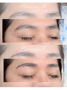 プリンセスアール(Princess R)/美眉トータルケア