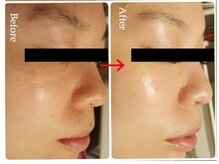 ピュールエクラ(PUR ECLAT)/