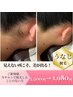 うなじ脱毛、整うだけで垢抜ける！初回1,980円