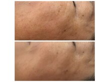 デトックスシェイプラボ 錦糸町(D:S Lab)の雰囲気(フェイシャルも大人気です!!!)