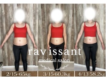 ラヴィソン(ravissant)の写真/何をしても痩せなかった方へ☆3ヶ月で8キロ減！体重だけじゃない！自信まで変わる3ヶ月◎
