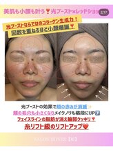 サロン 稲(SALON IIIINEE)/光ブーストの威力なのさっ！