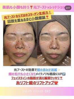 サロン 稲(SALON IIIINEE)/光ブーストの威力なのさっ!