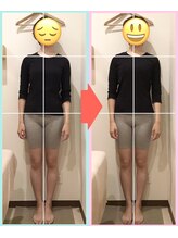 なぎさ整骨院/整体5回目