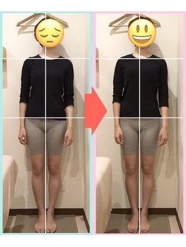 なぎさ整骨院/整体5回目