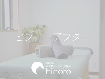 ヒノト(hinoto)/お客様ビフォーアフター