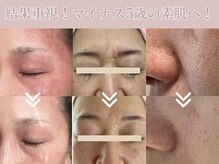 リール(rire)の雰囲気（結果重視！素肌美人へ！貴方の肌質改善を徹底サポートします）