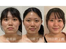 ロータス ビューティー(LOTUS Beauty)の雰囲気（理想のフェイスラインへ★フォトギャラリーに症例写真多数あり。）