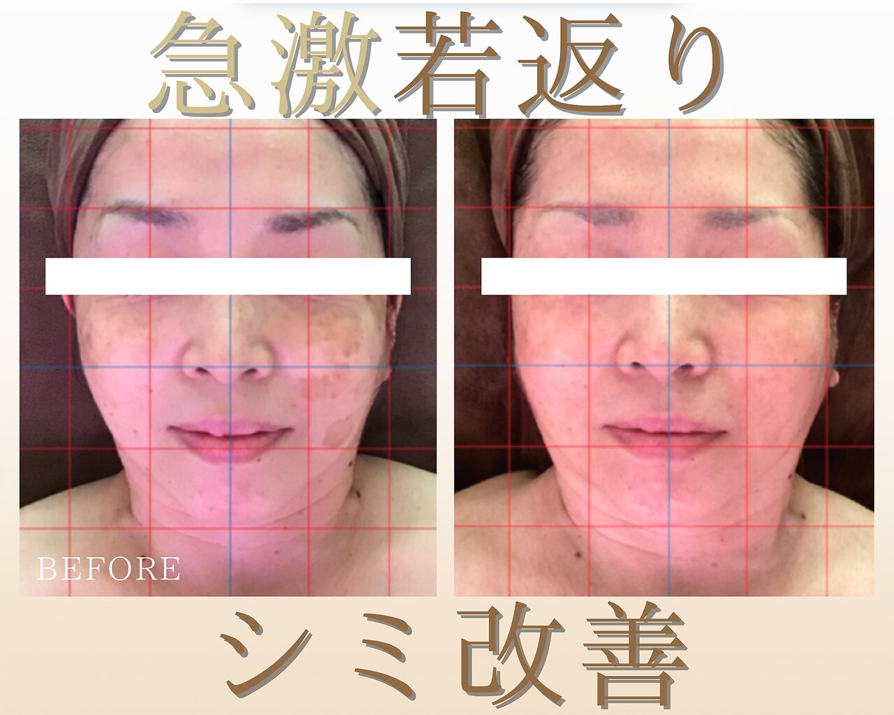 フェイシャルプロ 大阪京橋｜ホットペッパービューティー