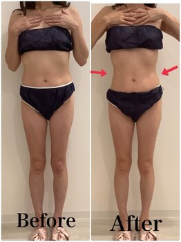 スペチアーレ 夙川/湘南や品川でも大人気の脂肪冷却