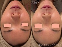 サロンヴェアリー 広尾(salon vary)/水玉リフティングテクスパ