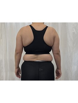 ボディラインを整えたい