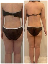 メゾン アンジュ(Maison Ange)/お腹1回目／レモンボトル