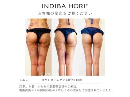 インディバ ホリ ナゴヤ ハニーズビューティー(INDIBA HORI NAGOYA Honey’s beauty)の写真