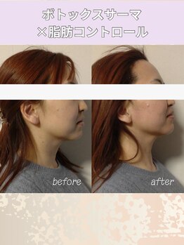 エン 橿原店(en)/30代フェイスラインにアプローチ