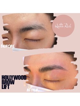 クィーンリッチ(Queen-Rich)/美眉【ハリウッドブロウリフト】