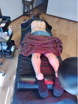 スーリール 鍼灸院 整体院(sourire)の写真/■鍼が初めての方…女性術者が丁寧に対応■肩こりに頭痛,眼精疲労など自律神経の不調も伴う方◎■美容鍼