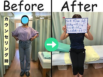 杉本接骨鍼灸院/ 【ダイエット】42歳　10.3キロ