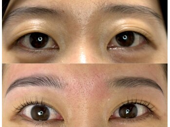 ノズ(NOZ)/眉毛まつ毛BeforeAfter