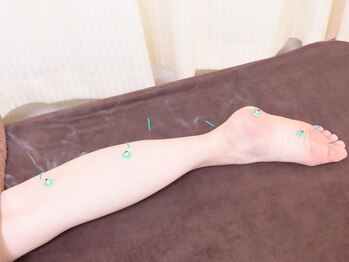 マック鍼灸院(MAC鍼灸院)/足のむくみが気になる方に