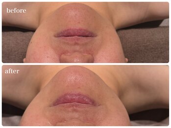 ビーグレイス(Vigrace)/ハイパーナイフEX/シェイプ