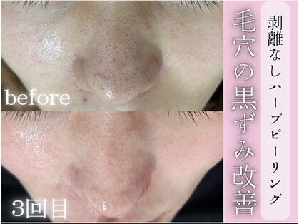 リネ(Rine)の写真