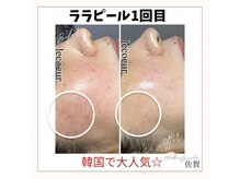 ルクール(Le coeur)の雰囲気（韓国発！剥離無しピーリング☆ハリ・ツヤ・透明感・水光肌）