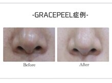 韓国肌管理・白玉肌管理 HOPE Retailer 安城店【3月OPEN（予定）】/施術写真