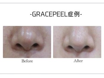 韓国肌管理・白玉肌管理 HOPE Retailer 安城店【3月OPEN(予定)】/施術写真