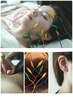 【人気No.3】通電美容鍼(耳つぼ3粒プレセント)+体通電鍼(肩凝り)¥9,900