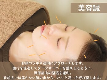 みずえ駅ビル整骨院/鍼灸施術　瑞江/鍼灸/美容鍼