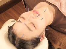 鍼灸Salonイブ【美容鍼/マッサージ/筋膜リリース/ヘッドスパ/肩こり/腰痛】新宿