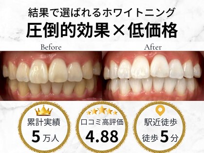 LBSホワイトニング 吉祥寺店の写真