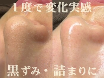 ダリア(Dahlia)の写真/毛穴の奥まで、するんとクリアに。触りたくなる肌へ、生まれ変わる体験。