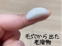 トルル(Tlulu)の雰囲気（【特許技術】スーパーデトックスフェイシャル！要らぬものは出す）