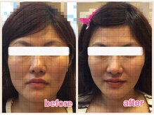 ヴィヴィアナ(viviana)/浮腫みともたつき解消したい方！