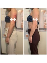 ネイルアンドリラクゼーション アン(nail&relaxation An)/脂肪冷却2カップ