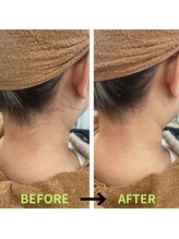 ティアナ(Tiana)/襟足を整えるとこんなに変わる！