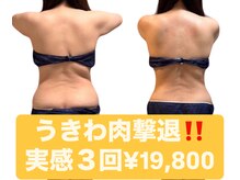 アンドミー 薬院店(&Me)