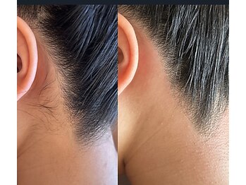 フルリール(Fleurir)/うなじワックス☆