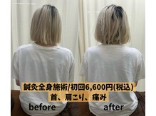 エムハナ鍼灸院(M.hana鍼灸院)/全身鍼灸施術ビフォーアフター