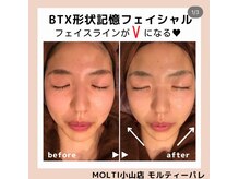 モルティーパレ(Molti Palais)/