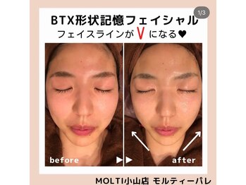 モルティーパレ(Molti Palais)/