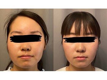 ルビー 池袋店(Ruby)/医療提携サロンRuby池袋