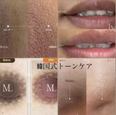 チョアビューティー(choa beauty)